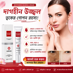 Youbuy Whitening Blemish Cream ( free Delivary )