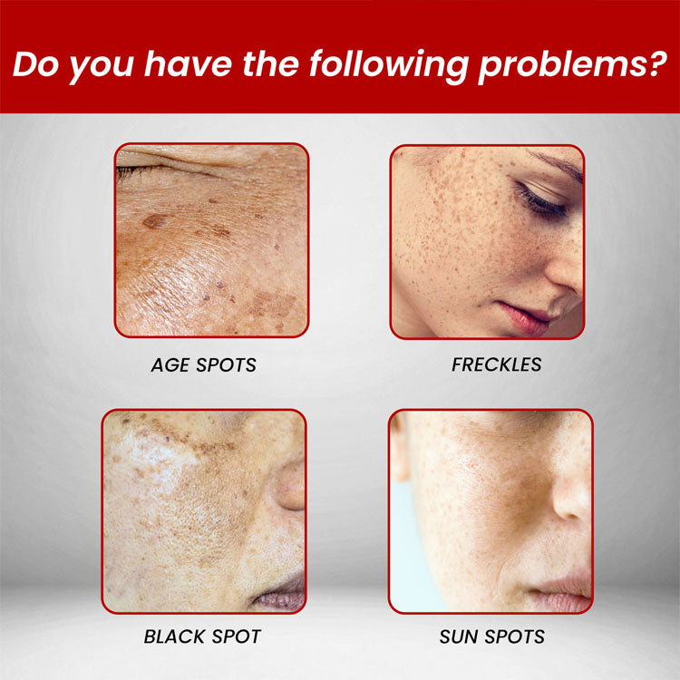 Youbuy Whitening Blemish Cream ( free Delivary )