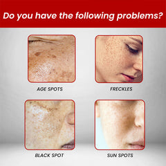 Youbuy Whitening Blemish Cream ( free Delivary )