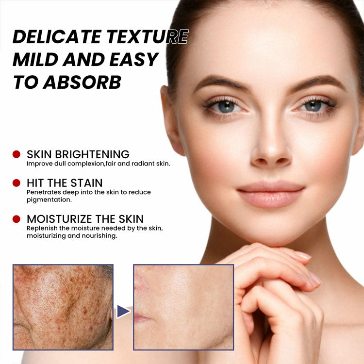 Youbuy Whitening Blemish Cream ( free Delivary )