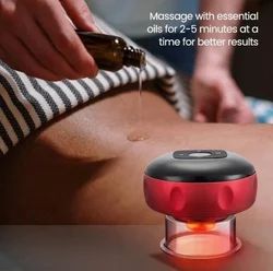 Cupping Therapy