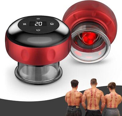 Cupping Therapy