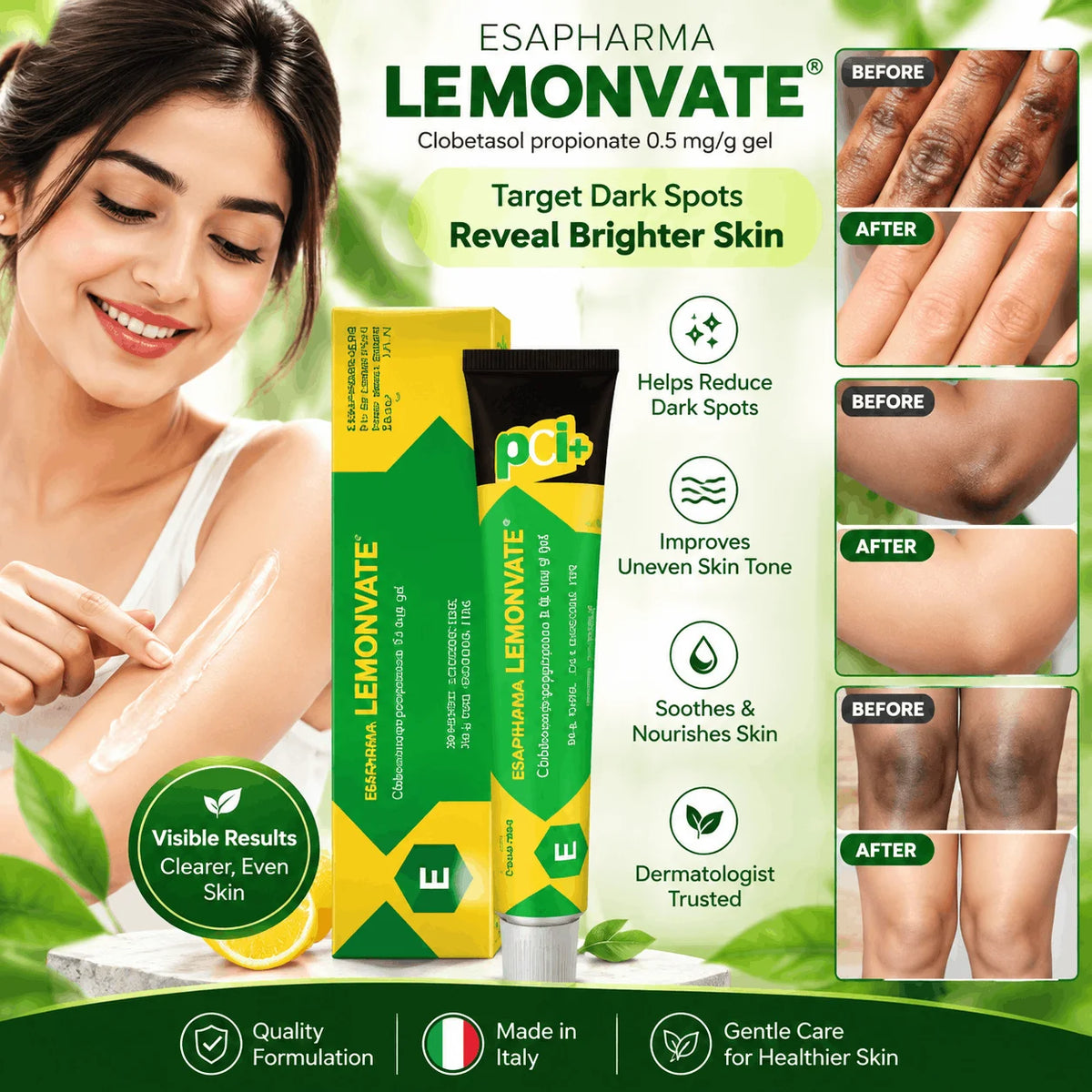 Lemonvate cream