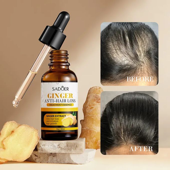 SADOER Ginger Anti Hair Loss Treatment Essence , Hair Growth Restoration Anti Hair Loss Serum
