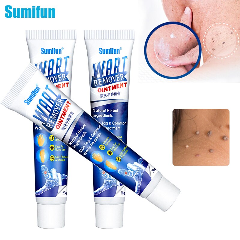 Sumifun Wart Remover Ointment