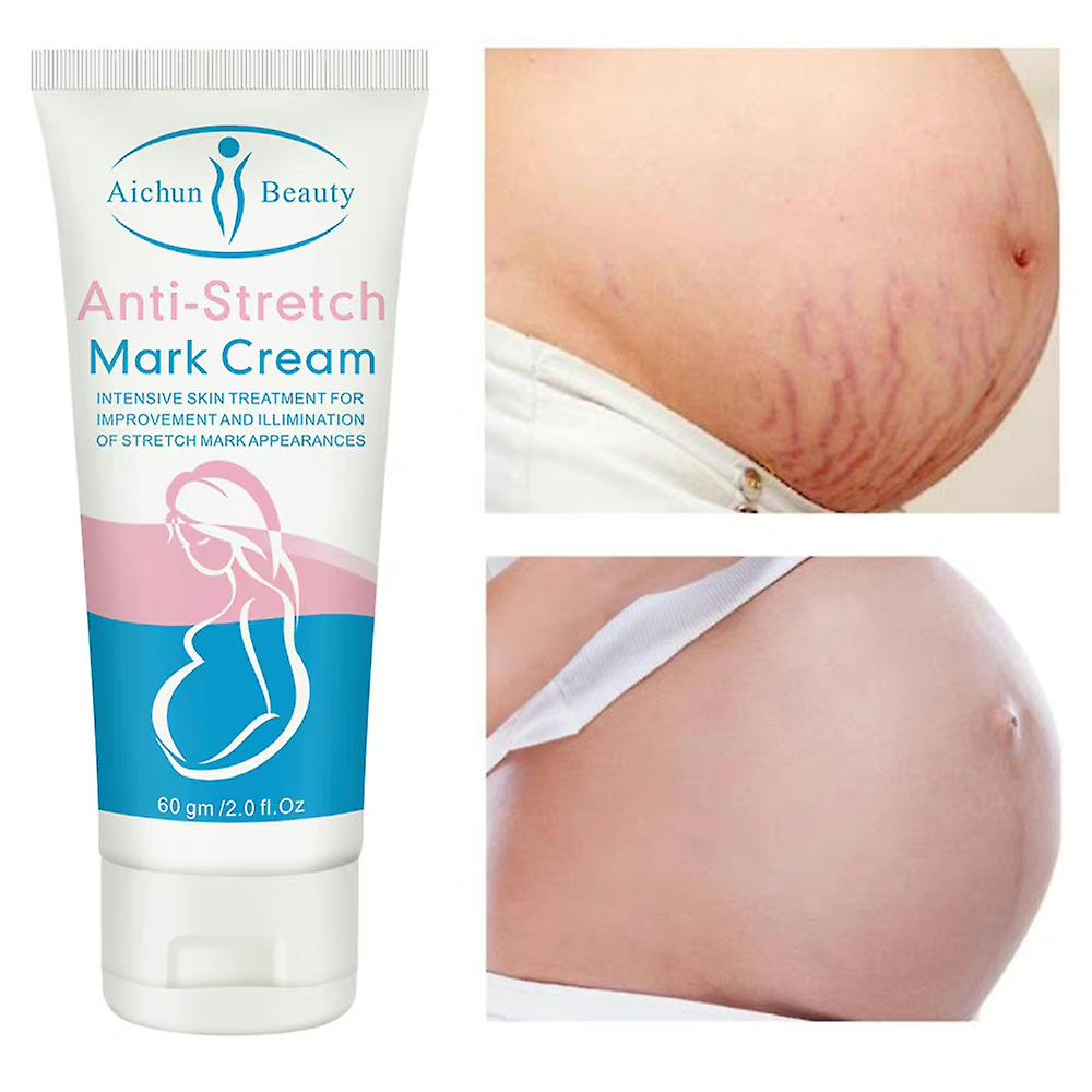 Anti Stretch Mark Cream - 60gm