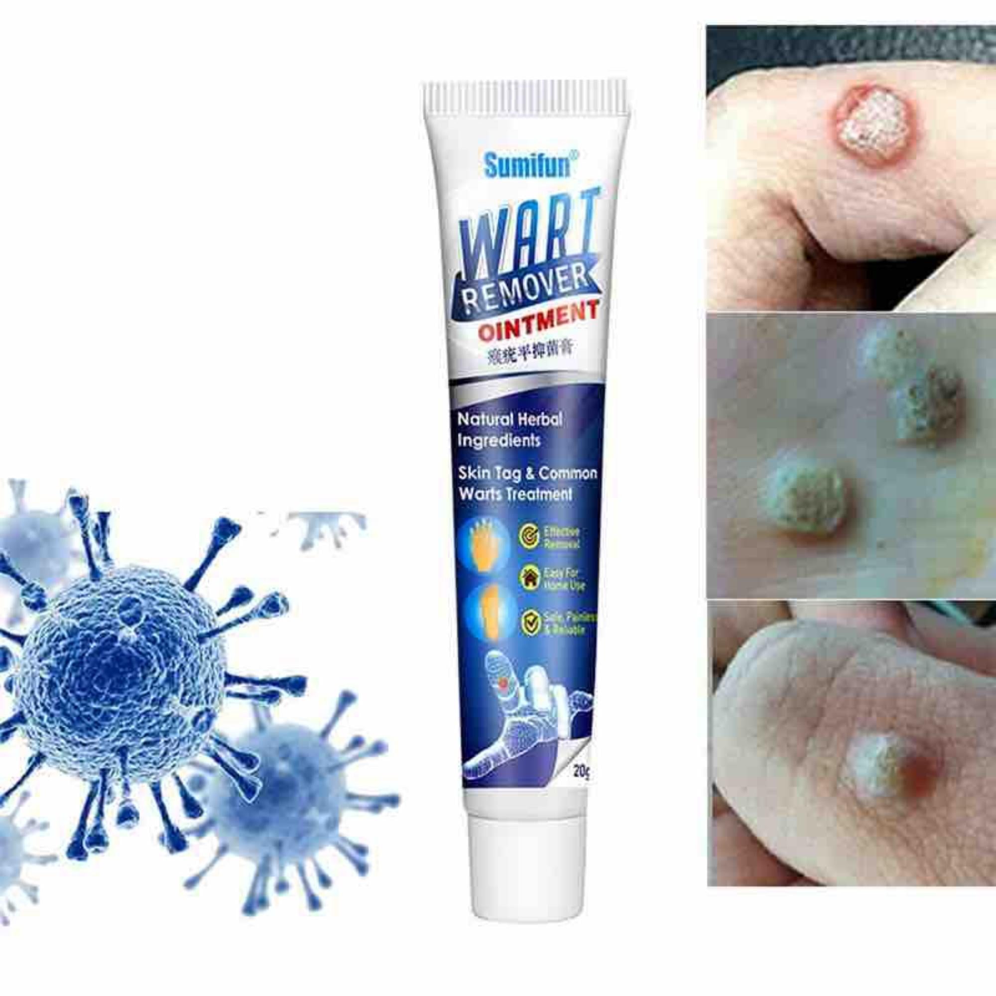 Sumifun Wart Remover Ointment