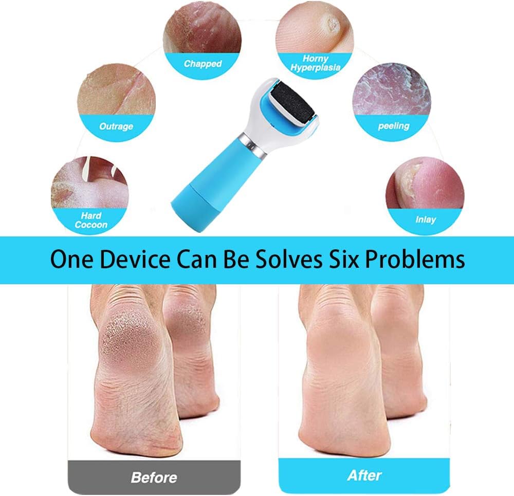 Electric Pedicure Callus Remover for Foot