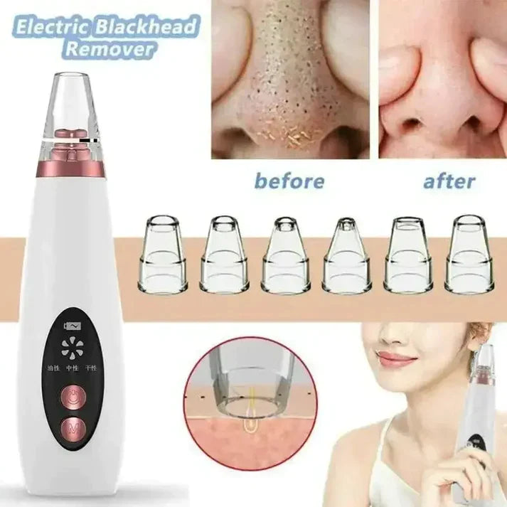 Blackhead Remover 6 In 1 Rechargeable